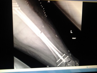 2014-04-10 08.08.20.jpg